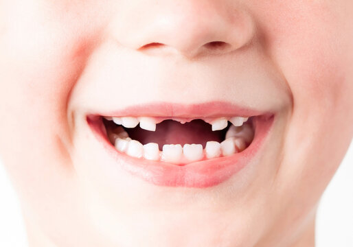 Children's teeth